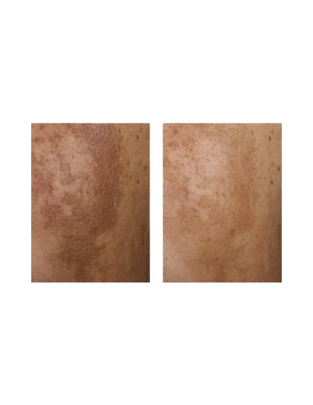 Eucerin Anti Pigment Crema Noche 50ML